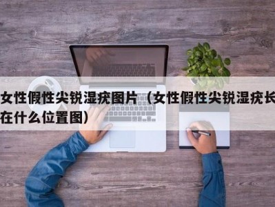女性假性尖锐湿疣图片（女性假性尖锐湿疣长在什么位置图）